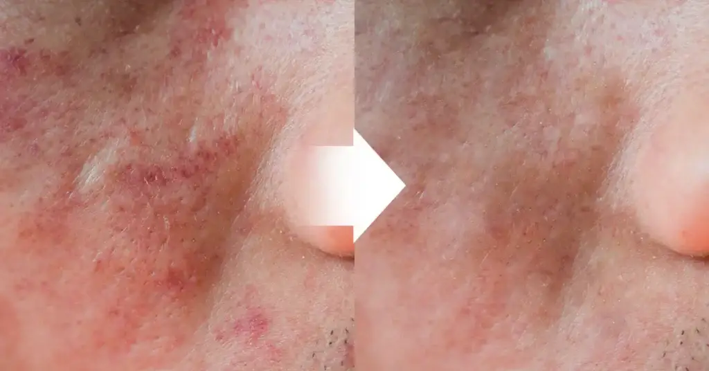 IMG1.1 (1)
