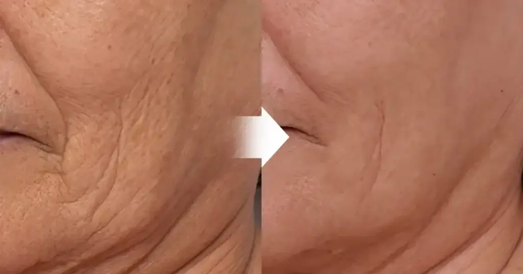 IMG1.3