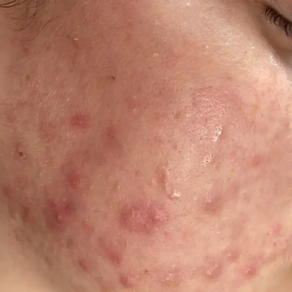 IMG3.5