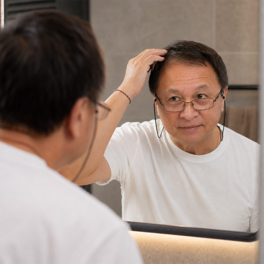 Advertorial Hair Loss Minoxidil
