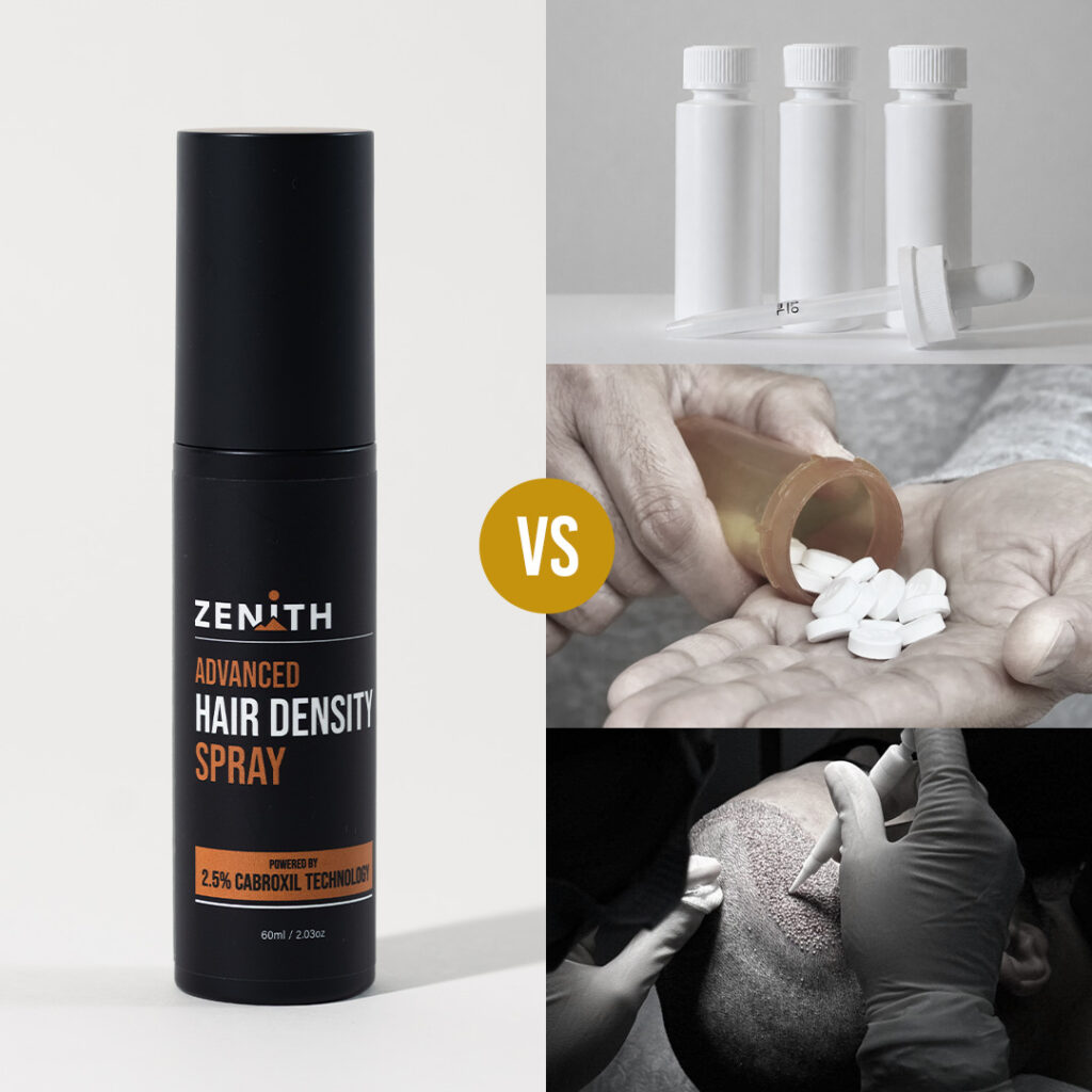 Advertorial Hair Loss Minoxidil